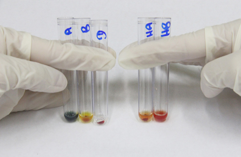 Tipagem sanguínea ABO e RhD