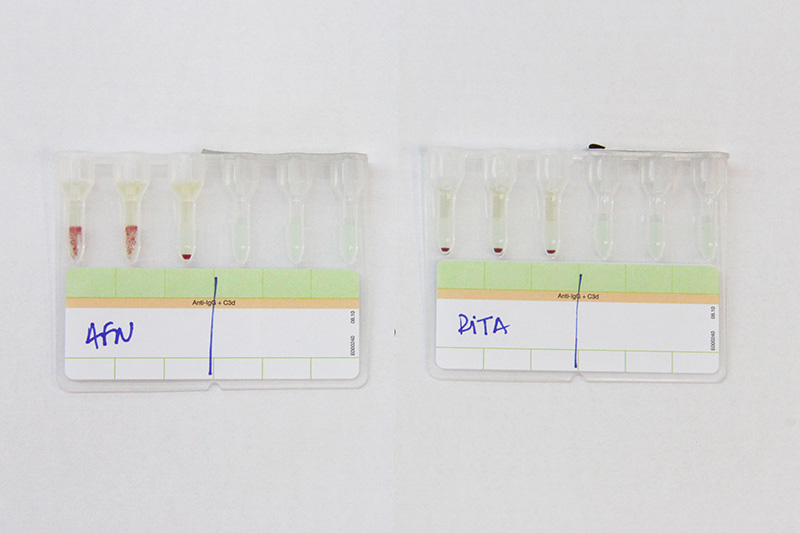 Identificação de anticorpos antieritrocitários irregulares