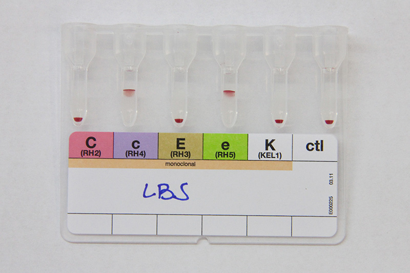 Fenotipagem eritrocitária