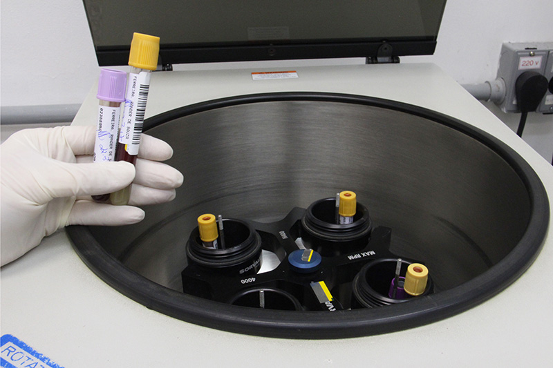 Exames imuno-hematológicos